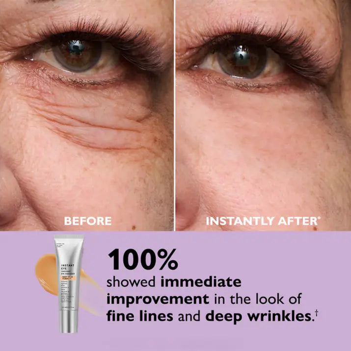 Instant Eye Lift Primer™