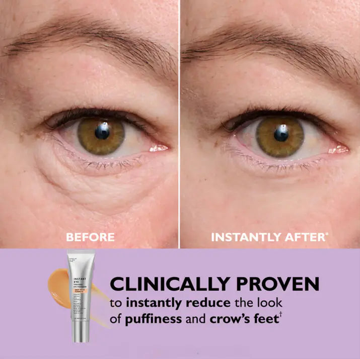 Instant Eye Lift Primer™